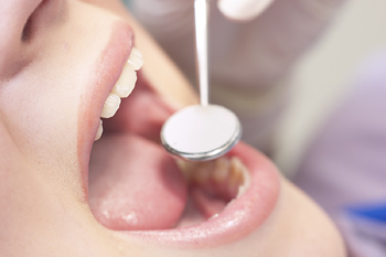 Xavier Leos Family Dentistry in Brownsville, TX | Dentists in Brownsville, TX | Teeth Whitening in Brownsville, TX Xavier Leos Family Dentistry in Brownsville, TX | Dentists in Brownsville, TX | Teeth Whitening in Brownsville, TX