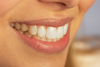 Xavier Leos Family Dentistry in Brownsville, TX | Dentists in Brownsville, TX | Teeth Whitening in Brownsville, TX Xavier Leos Family Dentistry in Brownsville, TX | Dentists in Brownsville, TX | Teeth Whitening in Brownsville, TX